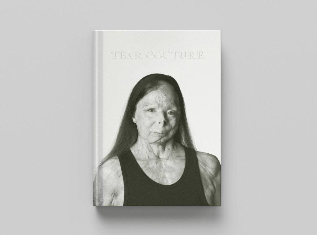 ASTI has recruited renowned photographer Rankin to help amplify a new campaign that aims to prevent the horror caused by acid attacks.