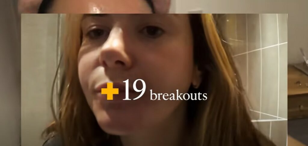 Screenshot from Skin + Me ad. Skincare brand Skin + Me has launched its first ever TV advertising campaign, using real subscribers rather than models in a first-of-its-kind move.