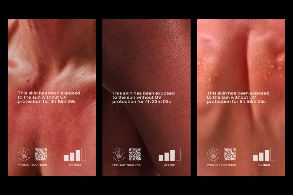 The British Skin Foundation highlights the dangers of sun damage in its latest campaign.