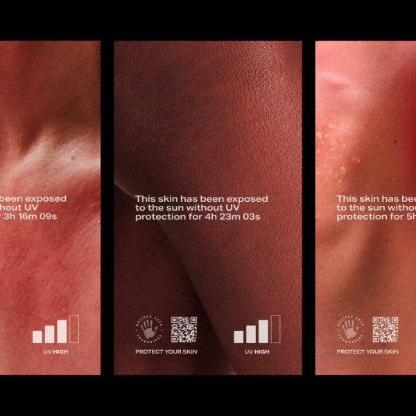 The British Skin Foundation highlights the dangers of sun damage in its latest campaign.